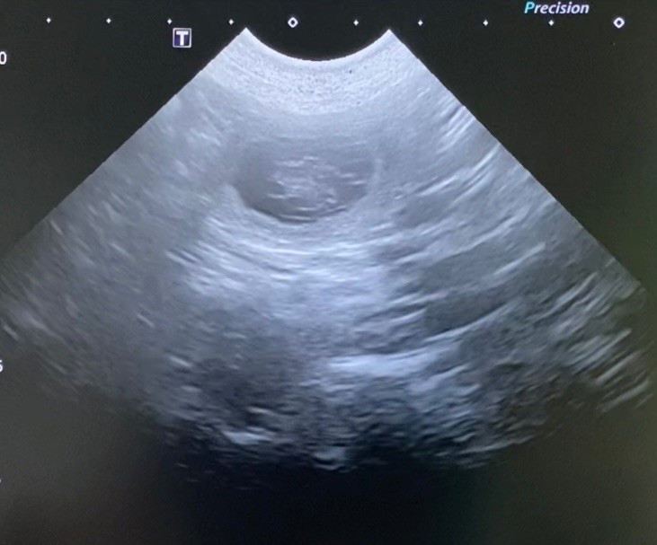 Gestation Confirmée 